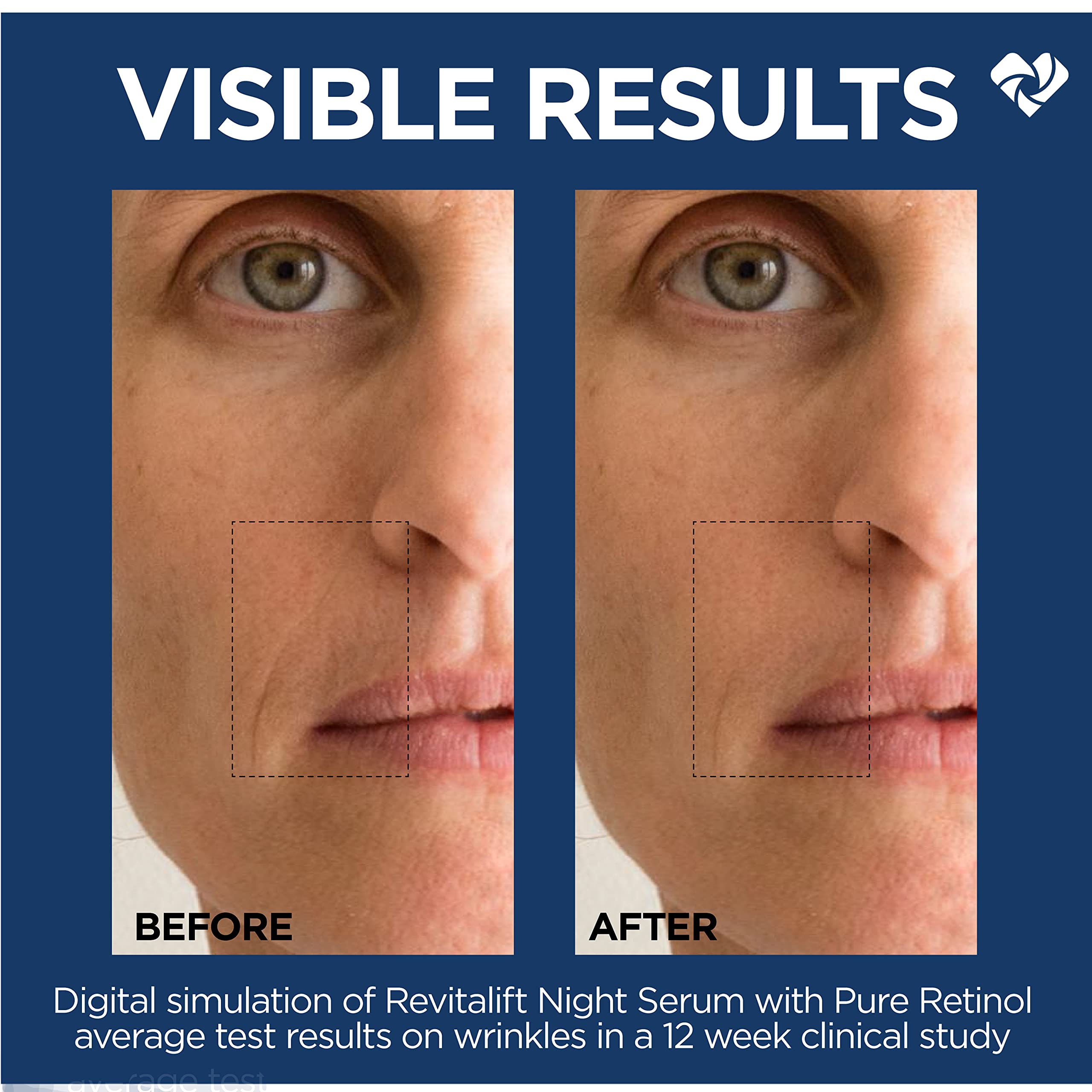 L'Oreal Paris Revitalift 0.3% Pure Retinol Night Serum, Reduce Deep Wrinkles, Fragrance Free 1 oz + Moisturizer Sample